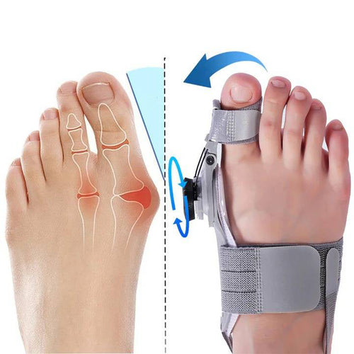 Correttore Alluce Valgo in Silicone Spaziatore per Dita per Comfort e Allineamento-VISOTKI