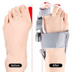 Correttore Alluce Valgo in Silicone Spaziatore per Dita per Comfort e Allineamento-VISOTKI