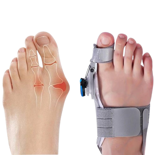 Correttore Alluce Valgo in Silicone Spaziatore per Dita per Comfort e Allineamento-VISOTKI