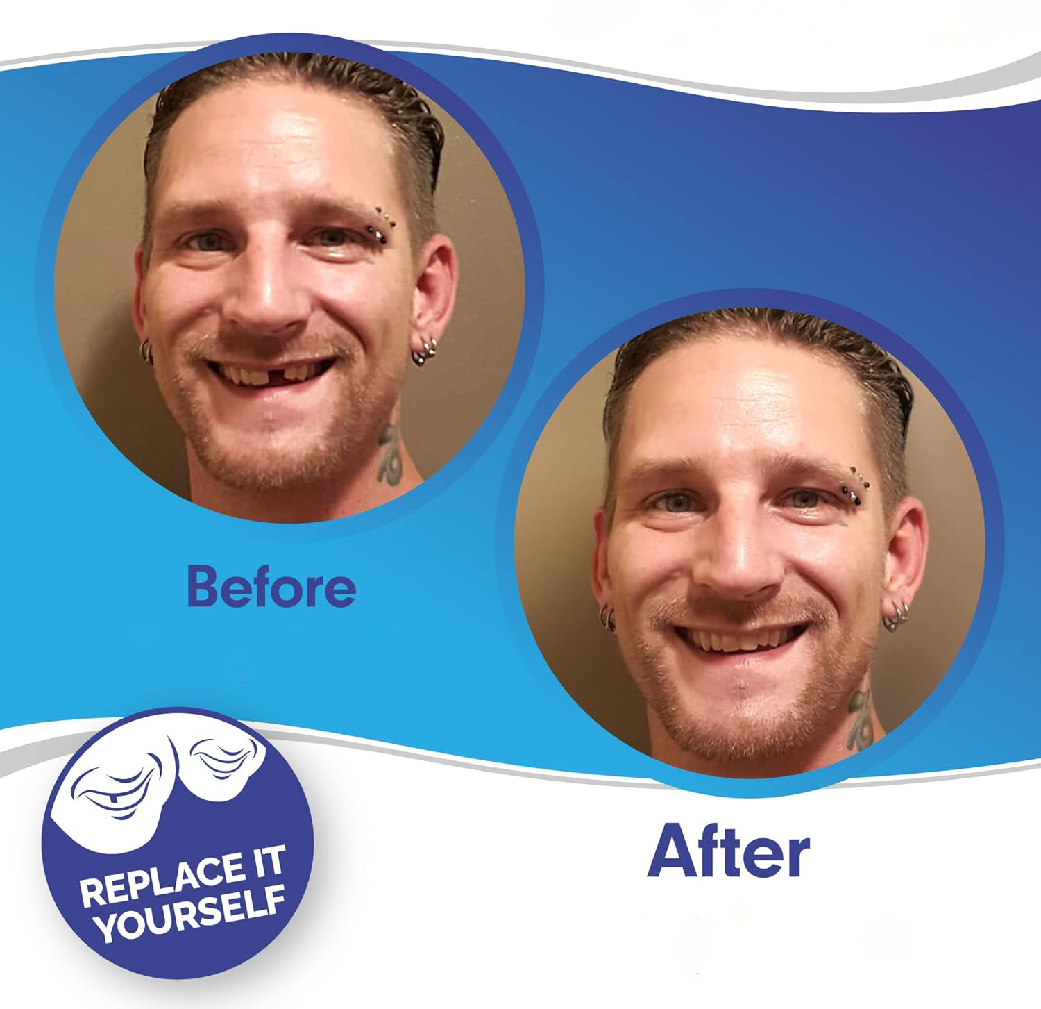 Faccetta Smile in Resina Composita - Design Naturale per Estetica Dentale - Inclusi Superiori e Inferiori-VISOTKI