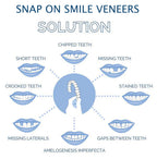 Faccetta Smile in Resina Composita - Design Naturale per Estetica Dentale - Inclusi Superiori e Inferiori-VISOTKI