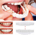 Faccetta Smile in Resina Composita - Design Naturale per Estetica Dentale - Inclusi Superiori e Inferiori-VISOTKI