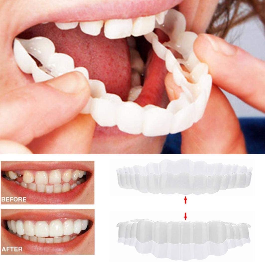 Faccetta Smile in Resina Composita - Design Naturale per Estetica Dentale - Inclusi Superiori e Inferiori-VISOTKI