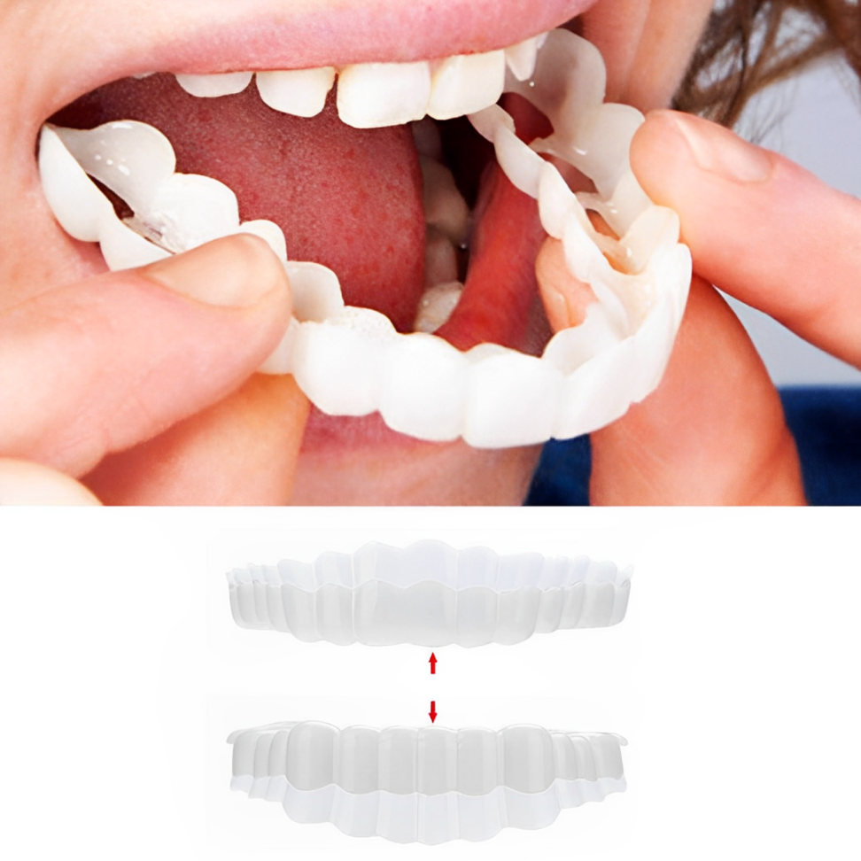 Faccetta Smile in Resina Composita - Design Naturale per Estetica Dentale - Inclusi Superiori e Inferiori-VISOTKI