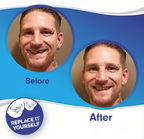 Faccette Dentali Veneer Smile - Superiori e Inferiori, Design Naturale per Sorrisi Perfetti-VISOTKI