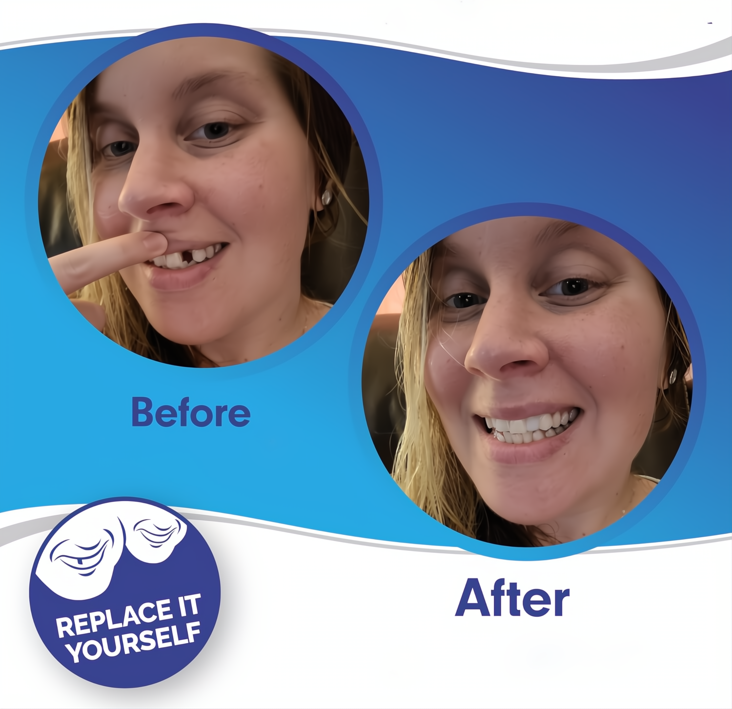 Faccette Dentali Veneer Smile - Superiori e Inferiori, Design Naturale per Sorrisi Perfetti-VISOTKI