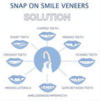 Faccette Dentali Veneer Smile - Superiori e Inferiori, Design Naturale per Sorrisi Perfetti-VISOTKI