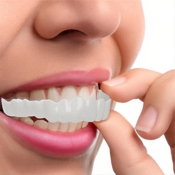 Faccette Dentali Veneer Smile - Superiori e Inferiori, Design Naturale per Sorrisi Perfetti-VISOTKI