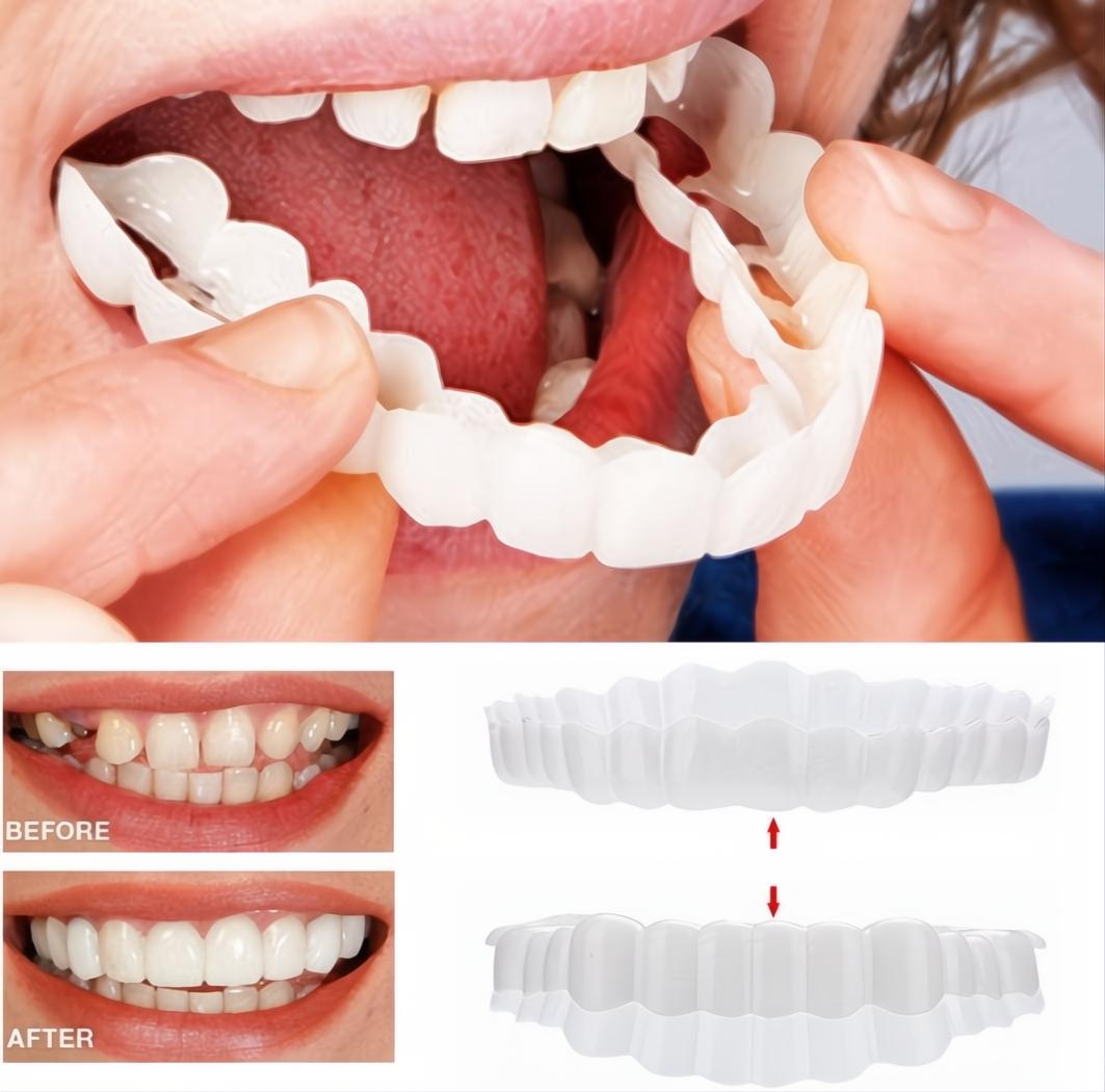 Faccette Dentali Veneer Smile - Superiori e Inferiori, Design Naturale per Sorrisi Perfetti-VISOTKI