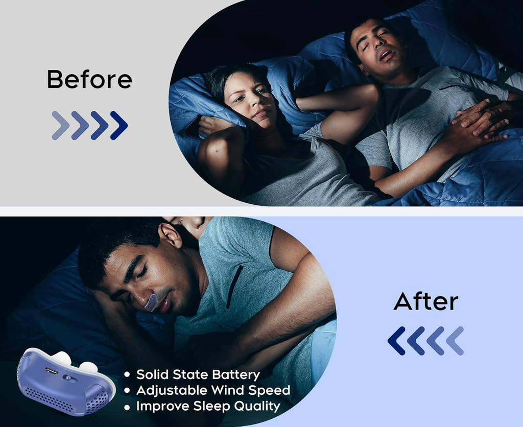 Micro CPAP per Apnea Notturna - Macchina Portatile Antirussamento per Viaggi, Compatta e Leggera-VISOTKI