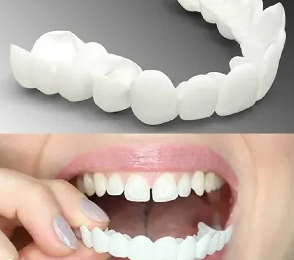 Protesi Dentali Regolabili in Materiale Resistente - Design Comfortevole per Uso Quotidiano - Facili da Indossare e Rimuovere-VISOTKI